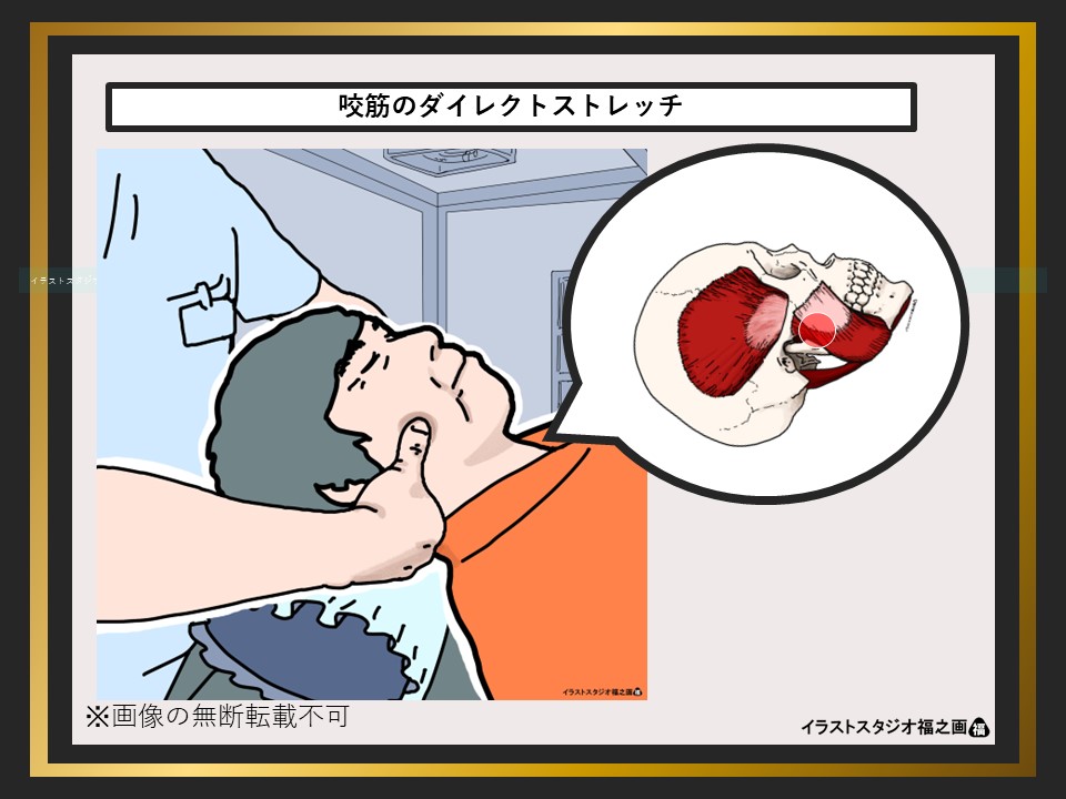 咬筋のダイレクトストレッチ