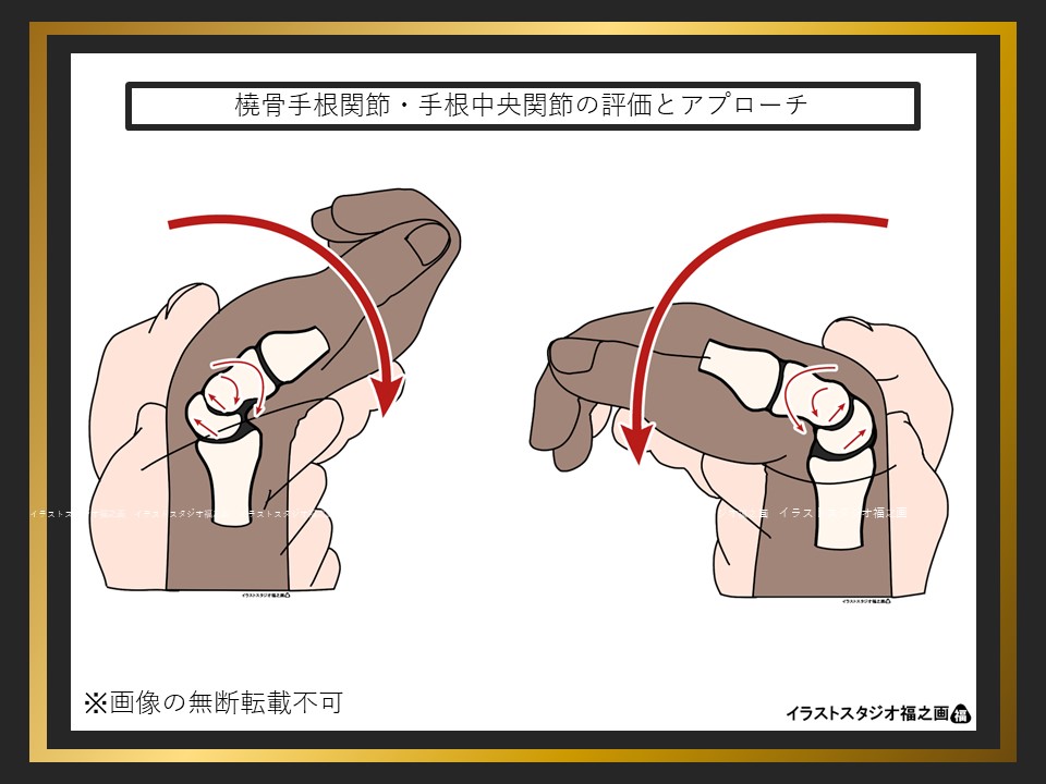橈骨手根関節・手根中央関節の評価とアプローチのイラスト