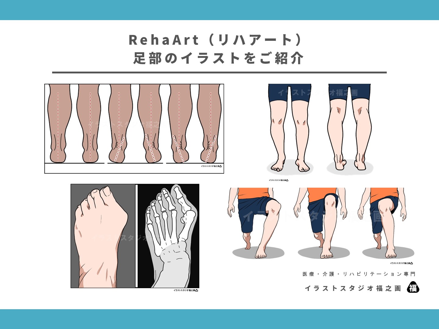 足部の解剖図・運動学図・症状・評価・治療のイラスト