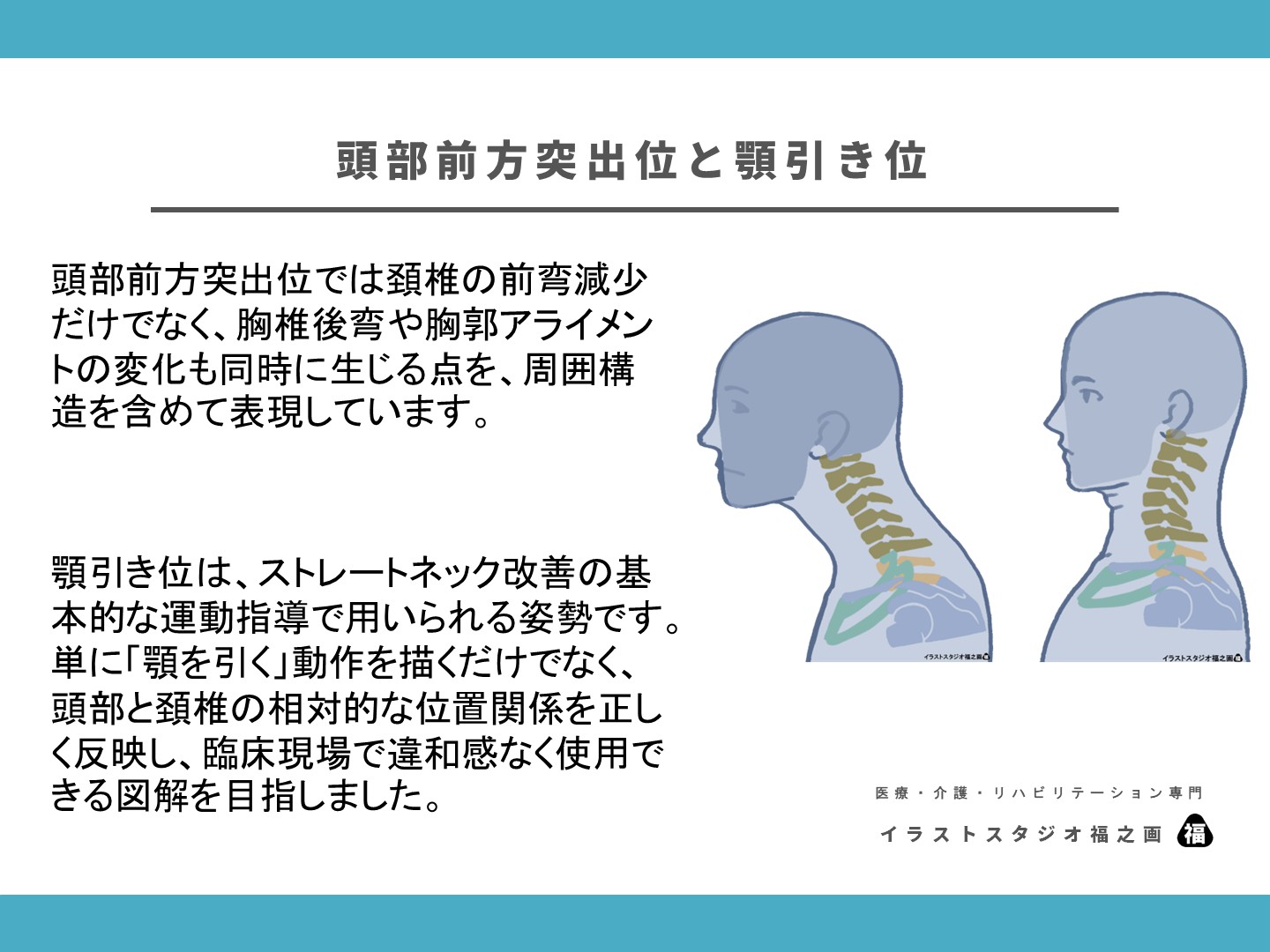 ストレートネック、顎引き、頚椎、姿勢、リハビリ、治療、評価、イラスト、図、解剖図2