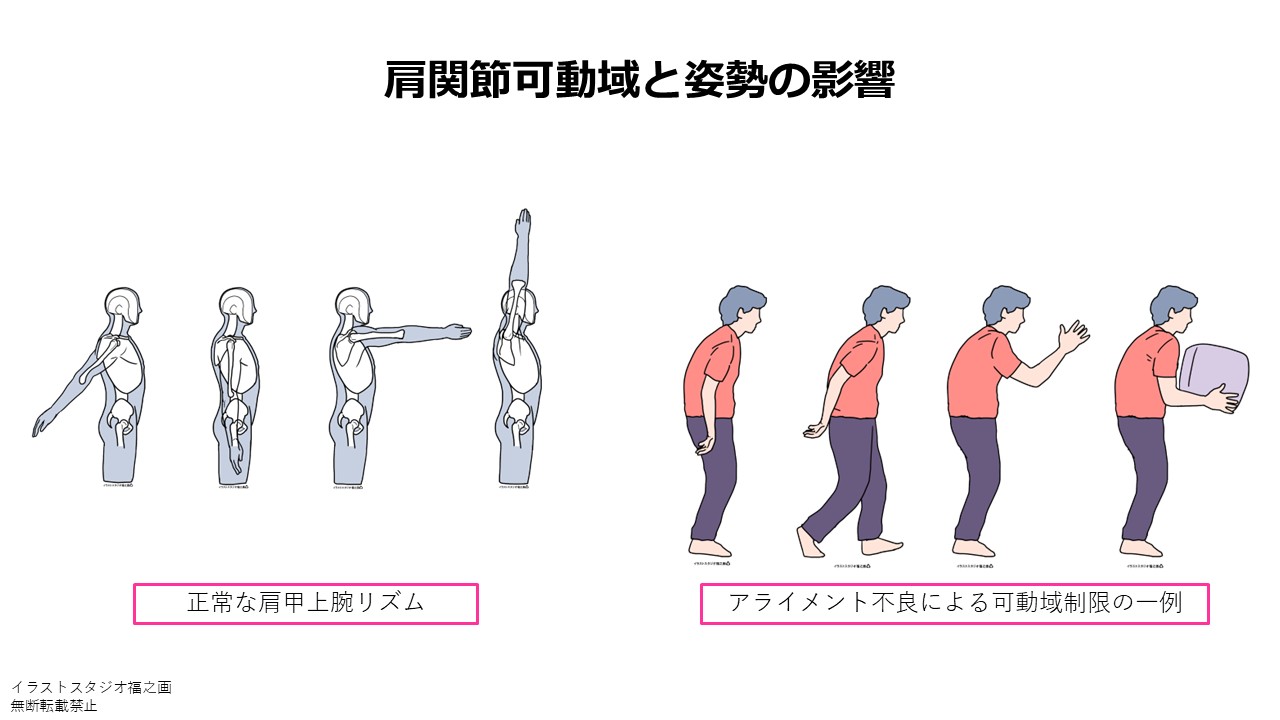 肩関節可動域と姿勢の影響