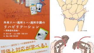 イラストで分かる掌屈時・背屈時の橈骨手根関節と手根中央関節の運動