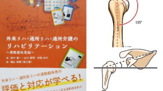 イラストで分かる上腕骨の頚体角・後捻角