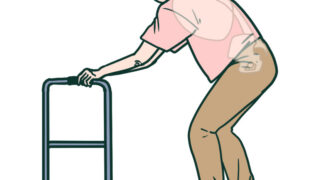 歩行器使用時にみられる前傾姿勢と依存的歩行―重心・筋活動から考える評価と運動プログラム―