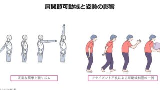 肩関節可動域評価で確認すべき胸郭・骨盤アライメント―肩甲胸郭関節の動きを考える