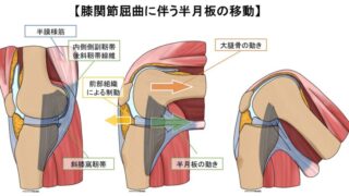 膝関節屈曲に伴う半月板後方移動の構造理解―膝窩部疼痛を張力機構から読み解く