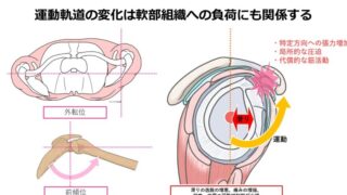 肩甲骨アライメント不良が肩関節評価に与える影響ー肩甲上腕関節の運動軌道を考える